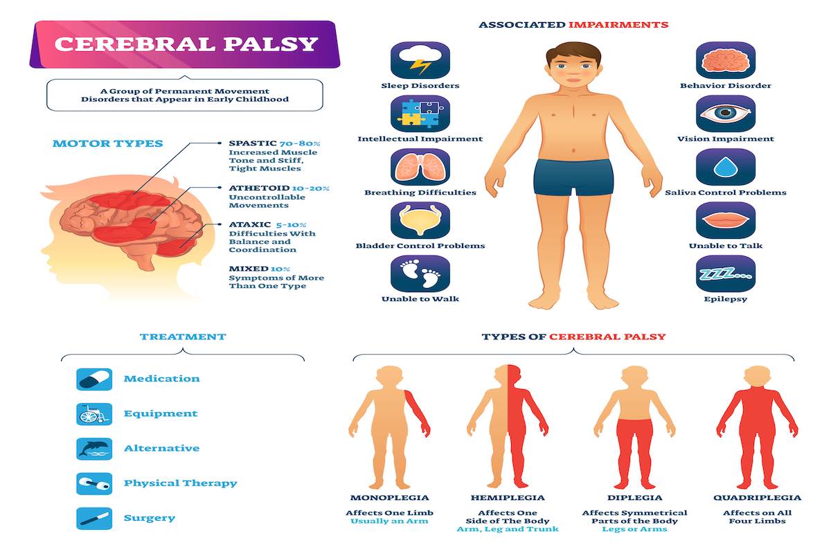 Cerebral Palsy LegalFinders